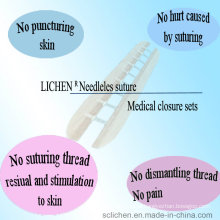 High Quality Surgical Suture No Needle Disposable Medical Consumable